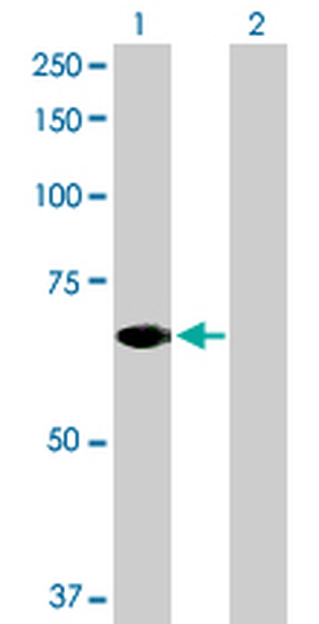 STAM2 Antibody in Western Blot (WB)