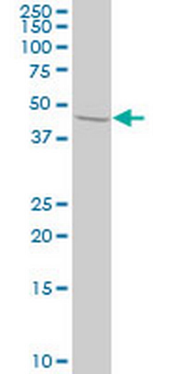 STAM2 Antibody in Western Blot (WB)