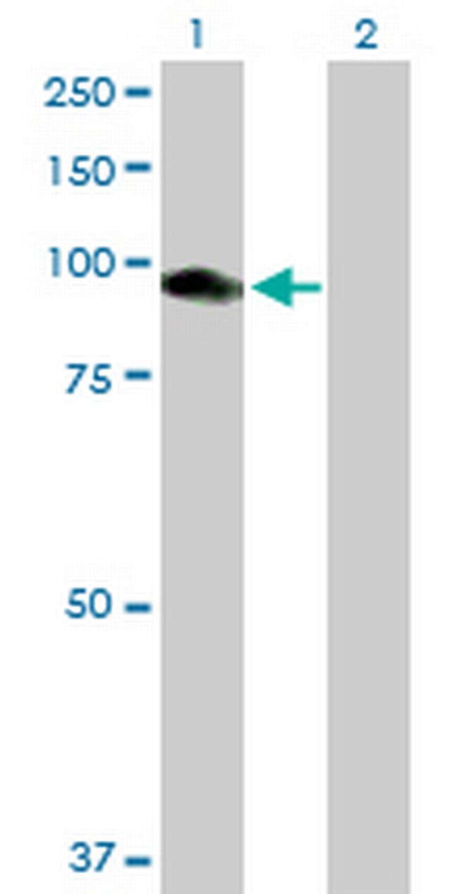 CNKSR1 Antibody in Western Blot (WB)