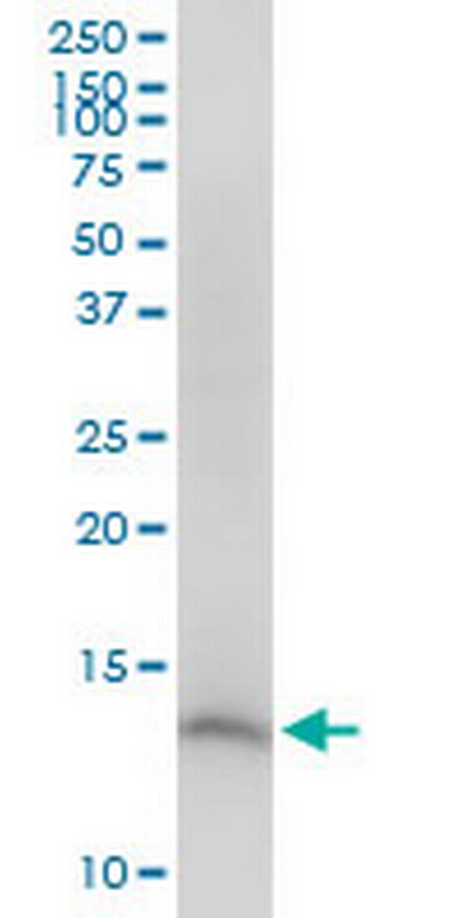 CDK2AP2 Antibody in Western Blot (WB)
