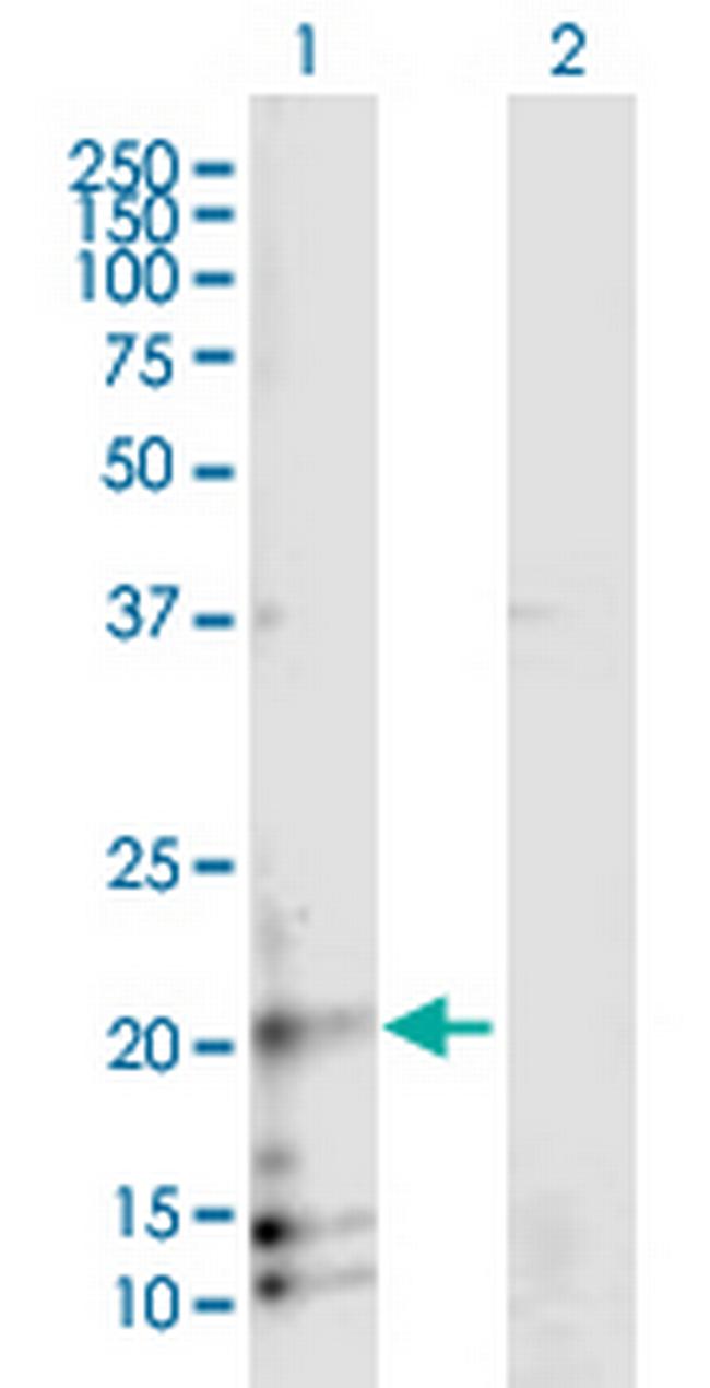 RAMP3 Antibody in Western Blot (WB)