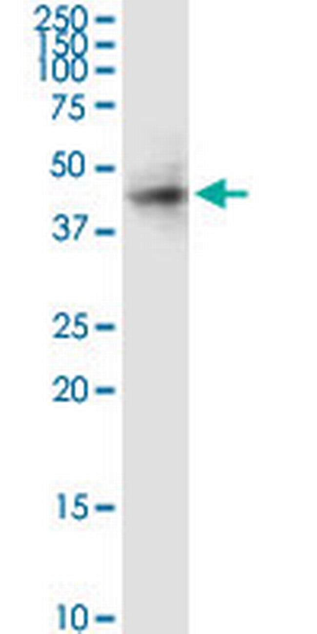 RAMP3 Antibody in Western Blot (WB)