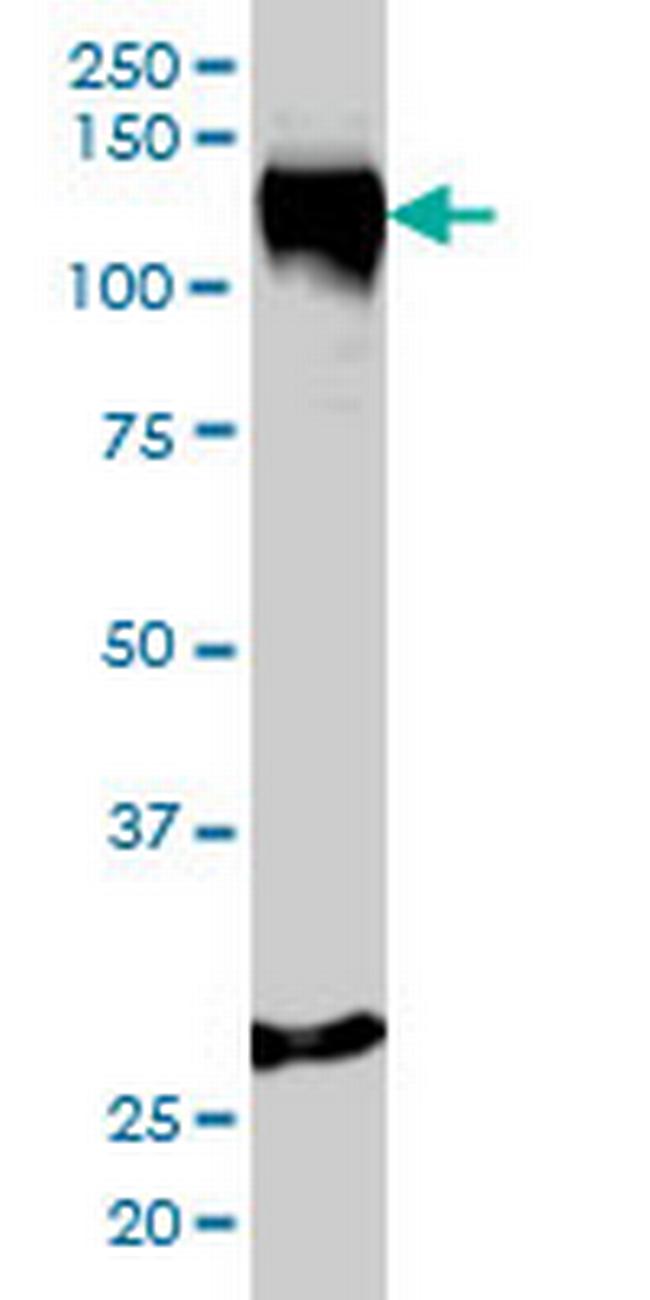 STAG1 Antibody in Western Blot (WB)