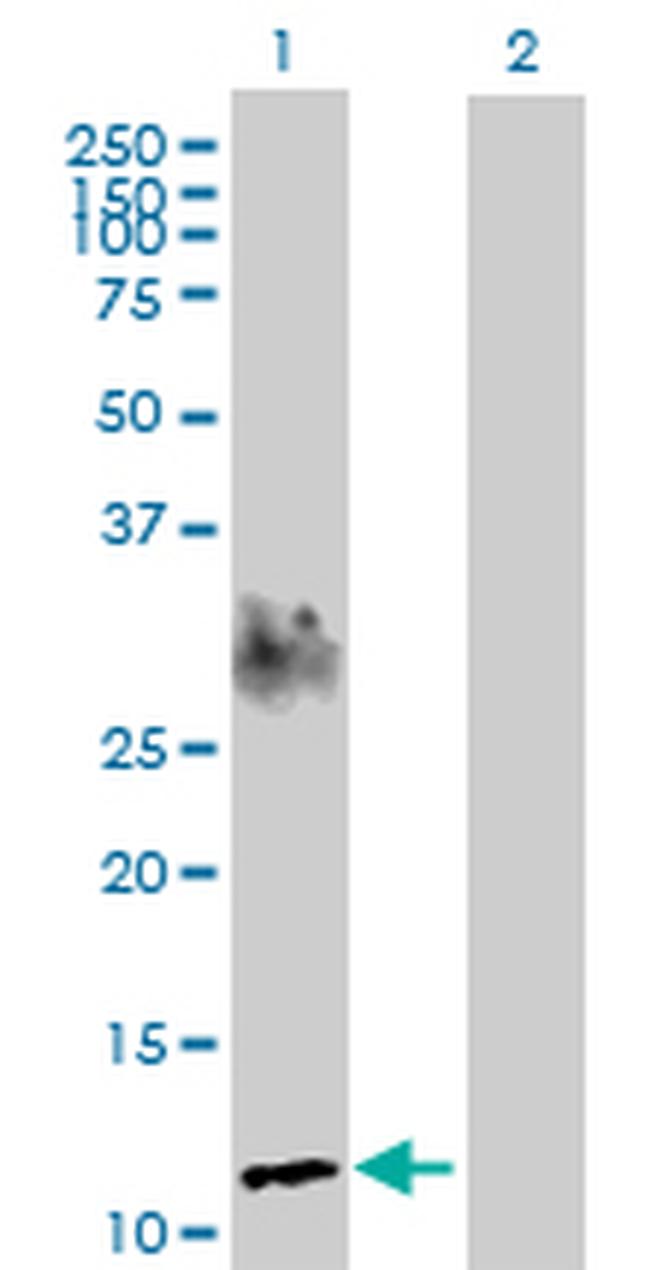 SPEG Antibody in Western Blot (WB)