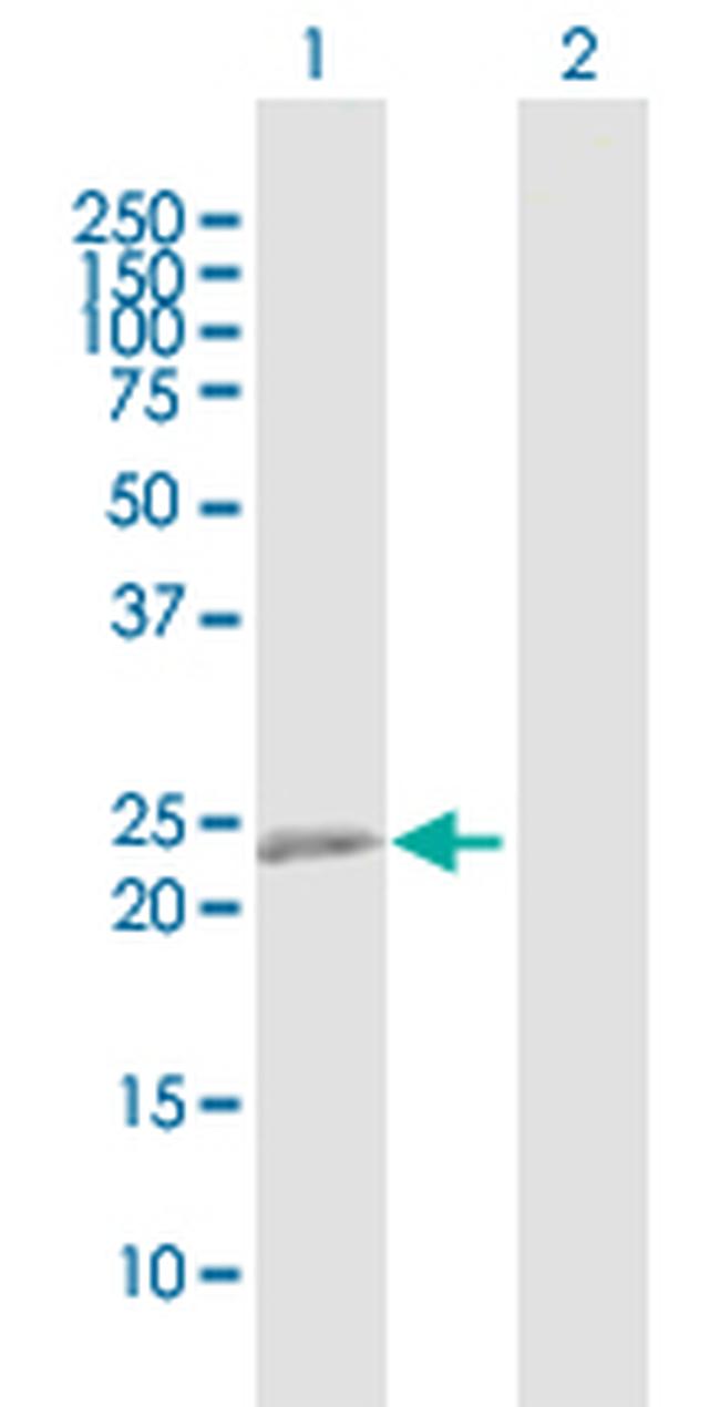 RTN3 Antibody in Western Blot (WB)