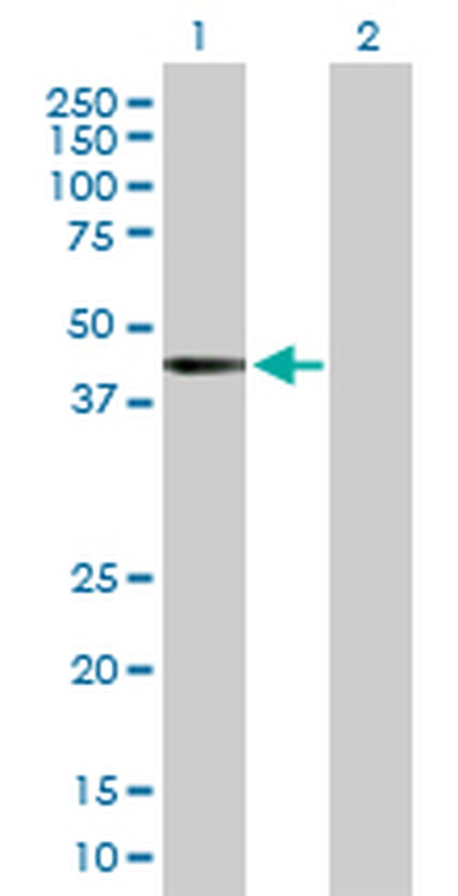 RRAGB Antibody in Western Blot (WB)