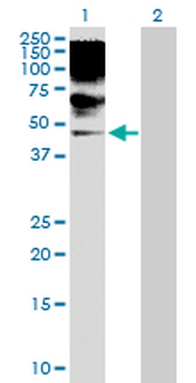 RRAGB Antibody in Western Blot (WB)