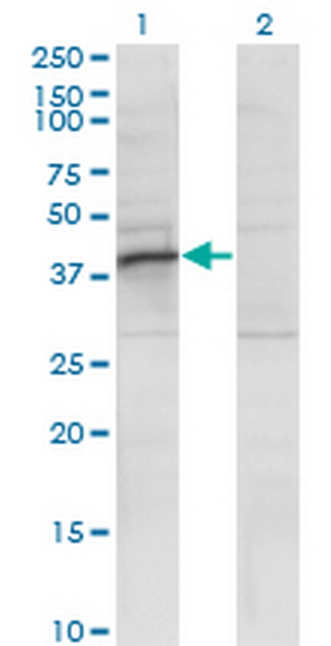 RRAGB Antibody in Western Blot (WB)