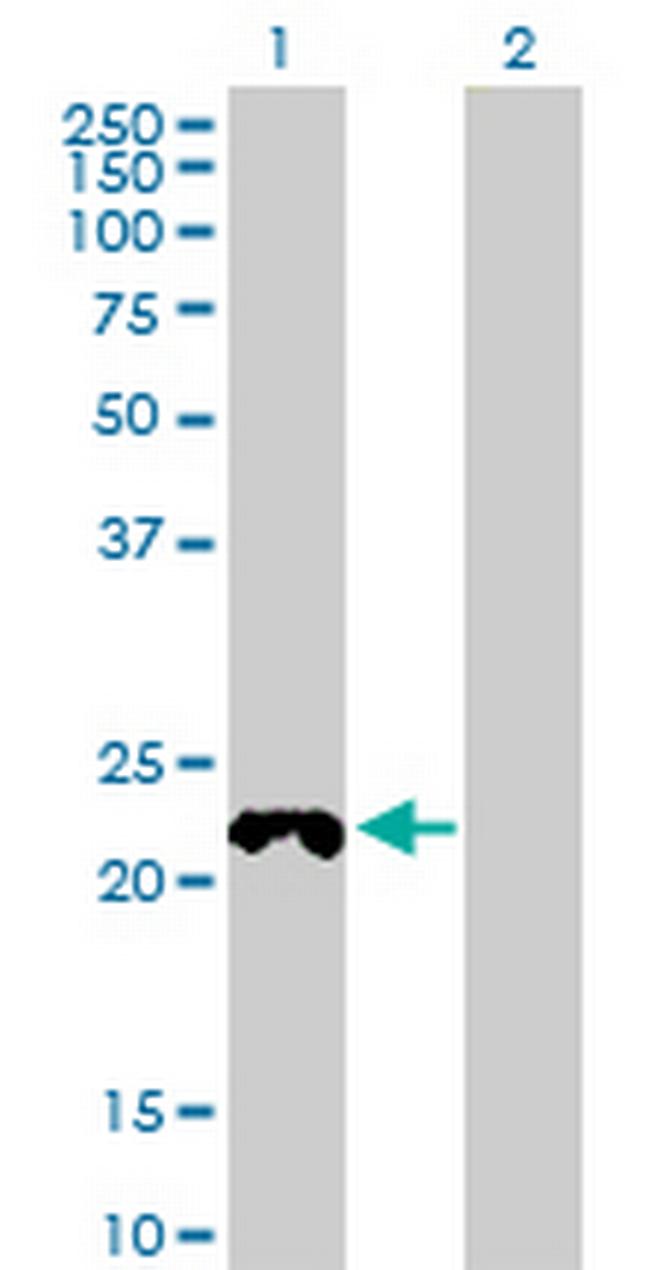 COX4NB Antibody in Western Blot (WB)