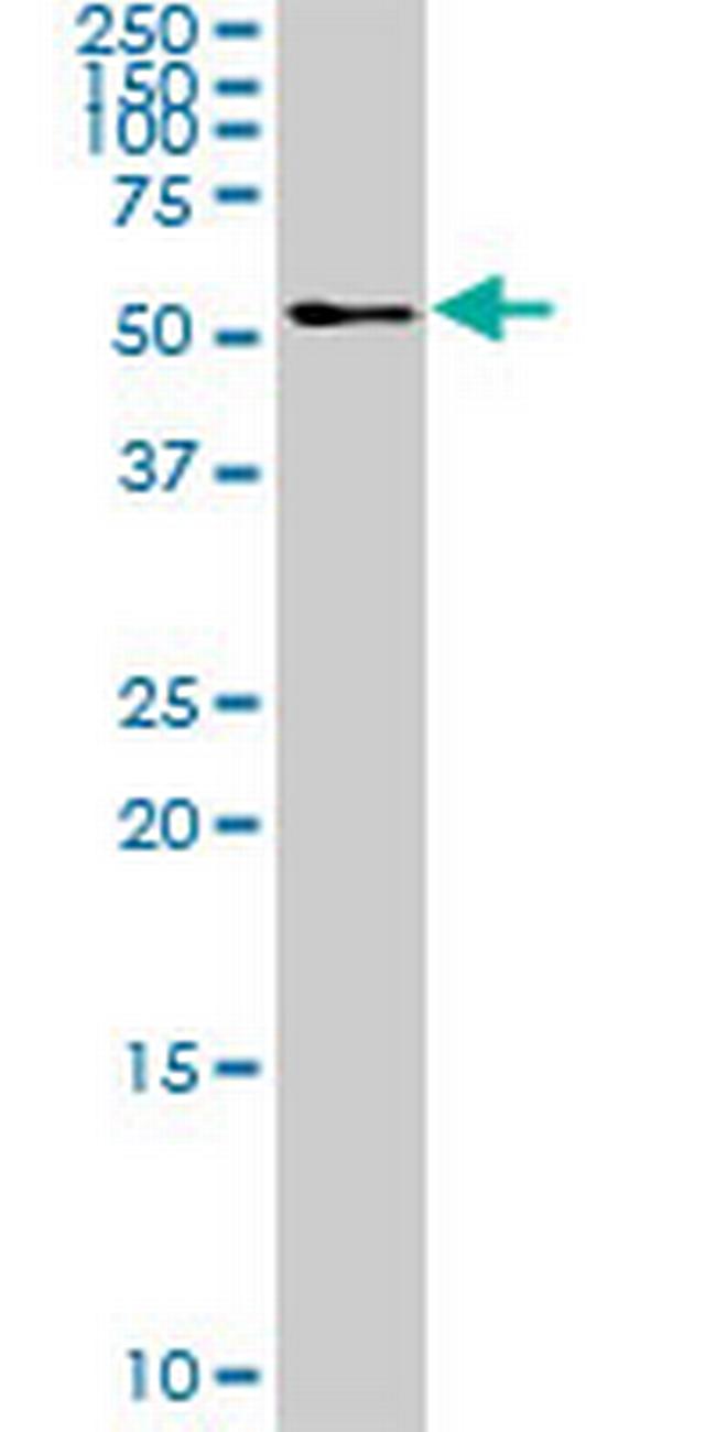 TFG Antibody in Western Blot (WB)