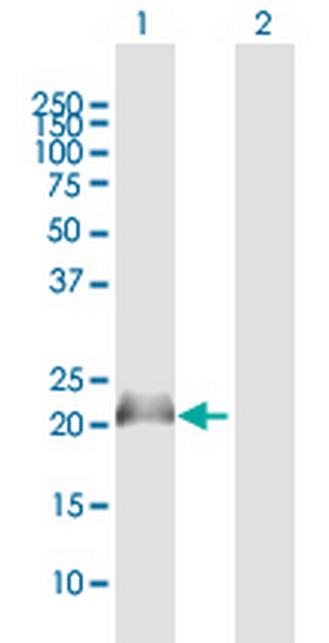 NPM3 Antibody in Western Blot (WB)
