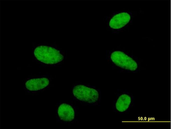 HMG20A Antibody in Immunocytochemistry (ICC/IF)