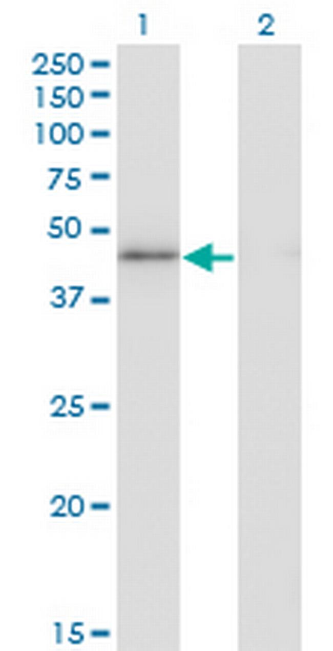HMG20A Antibody in Western Blot (WB)