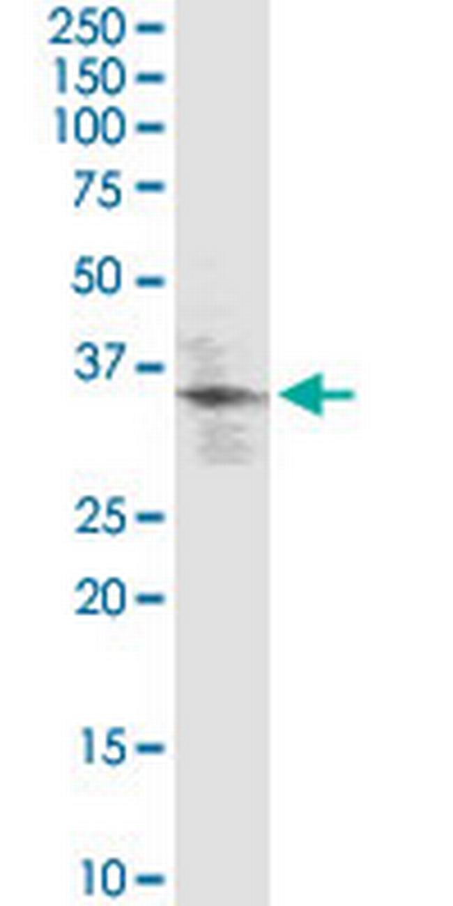 KLF2 Antibody in Western Blot (WB)