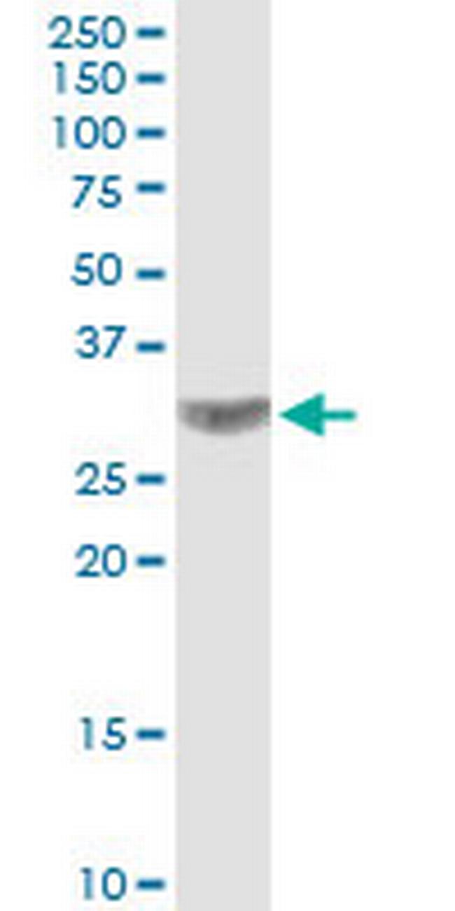 CACNG3 Antibody in Western Blot (WB)