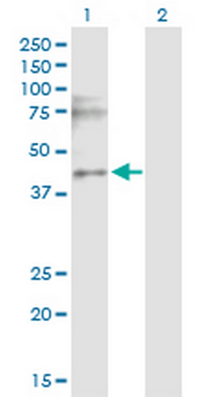CACNG3 Antibody in Western Blot (WB)