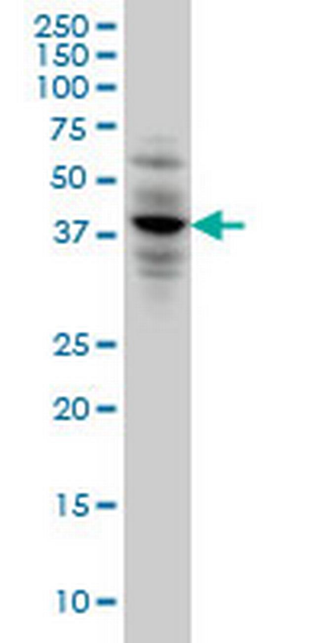 CACNG3 Antibody in Western Blot (WB)