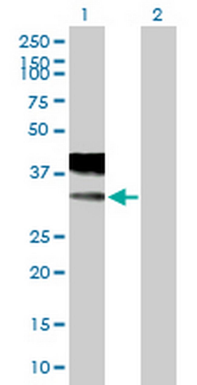 CACNG2 Antibody in Western Blot (WB)