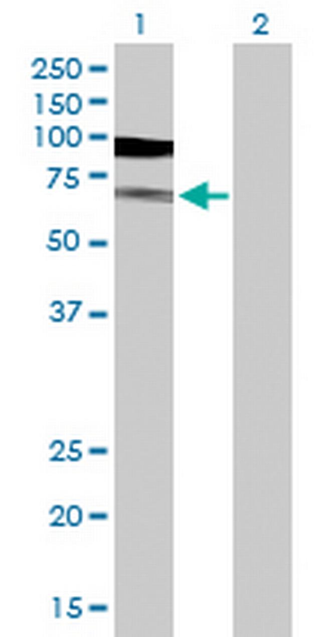 TUBA1B Antibody in Western Blot (WB)
