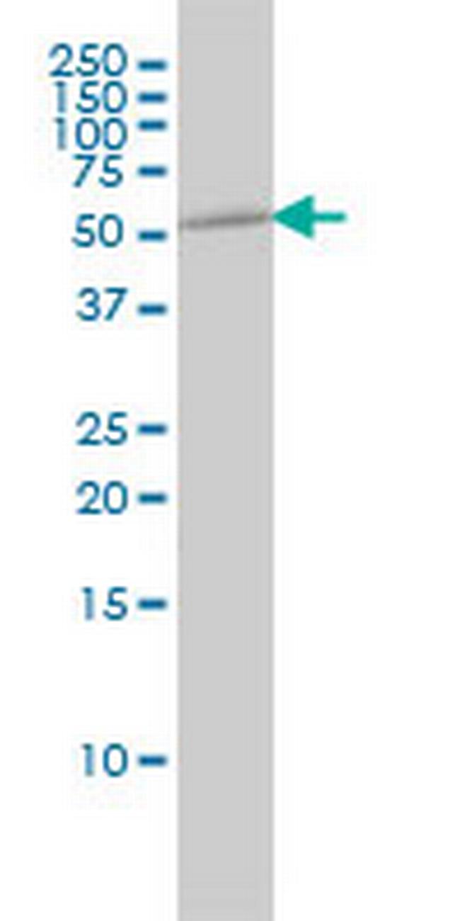 TUBA1B Antibody in Western Blot (WB)