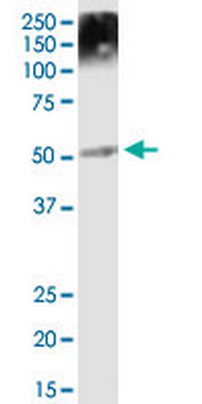 TUBA1B Antibody in Western Blot (WB)