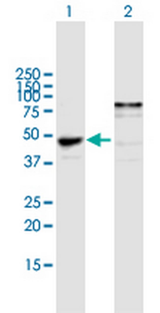 NDRG1 Antibody in Western Blot (WB)