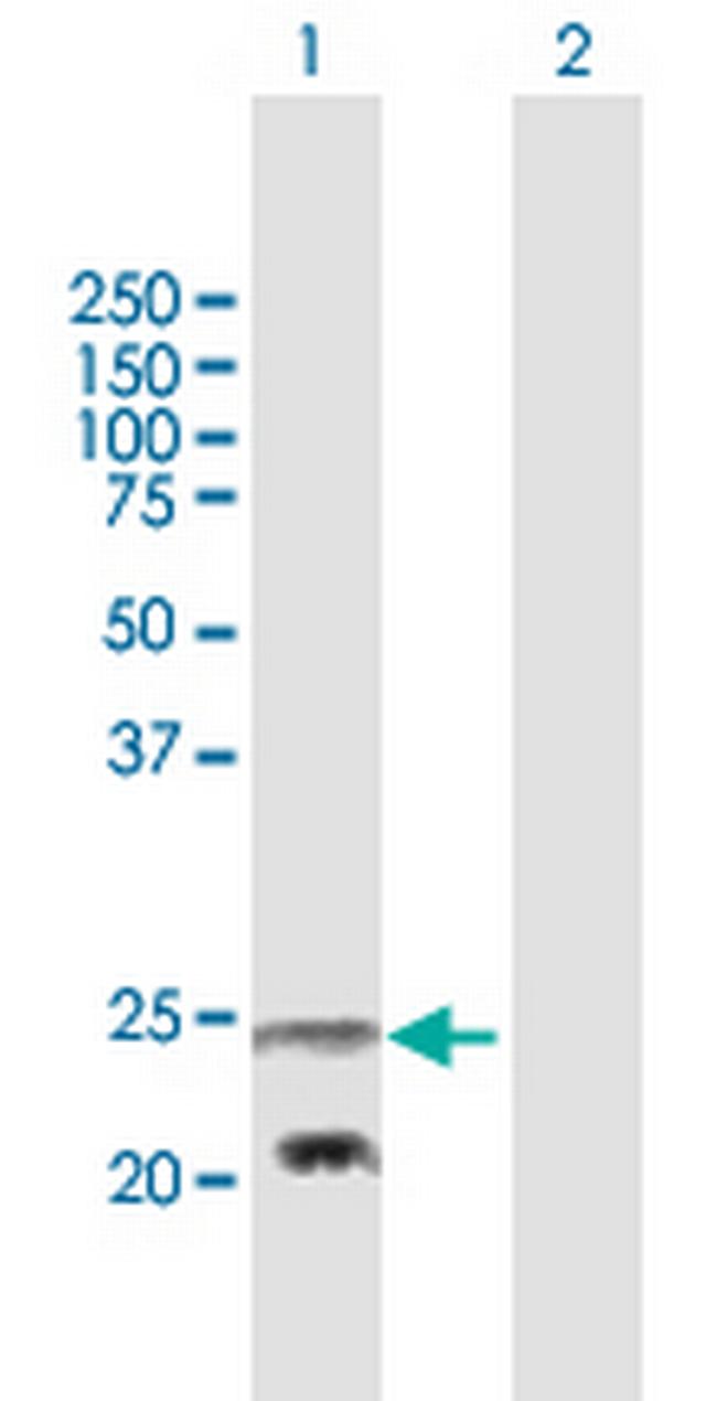 PEMT Antibody in Western Blot (WB)