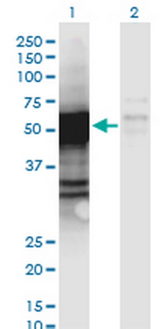 PGCP Antibody in Western Blot (WB)