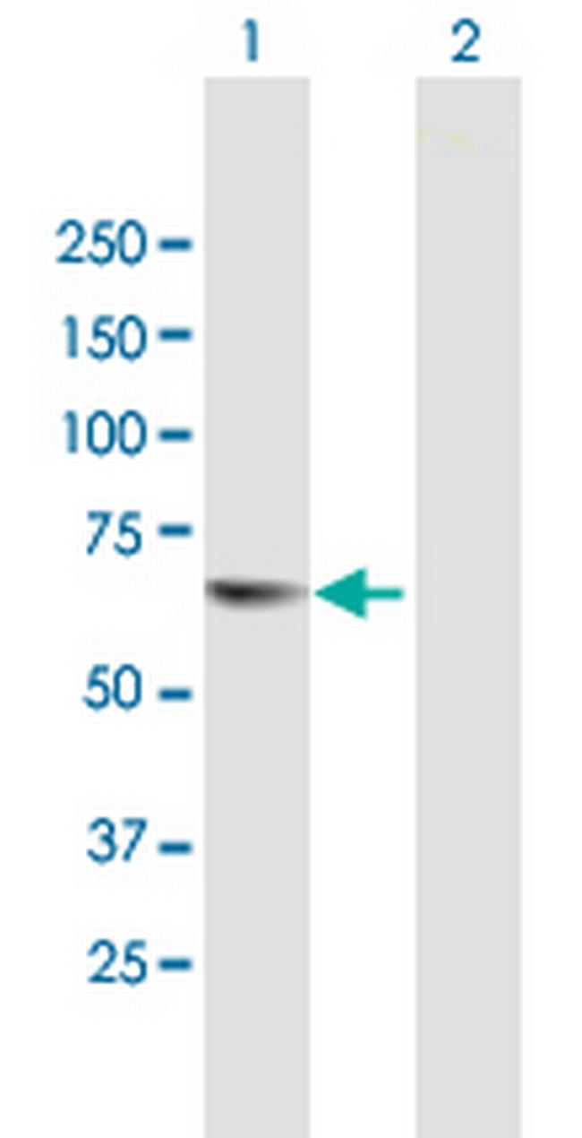 TESK2 Antibody in Western Blot (WB)