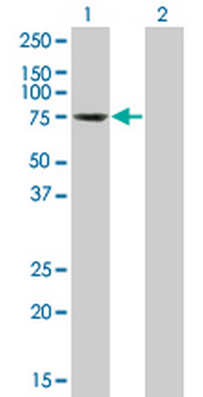 TESK2 Antibody in Western Blot (WB)