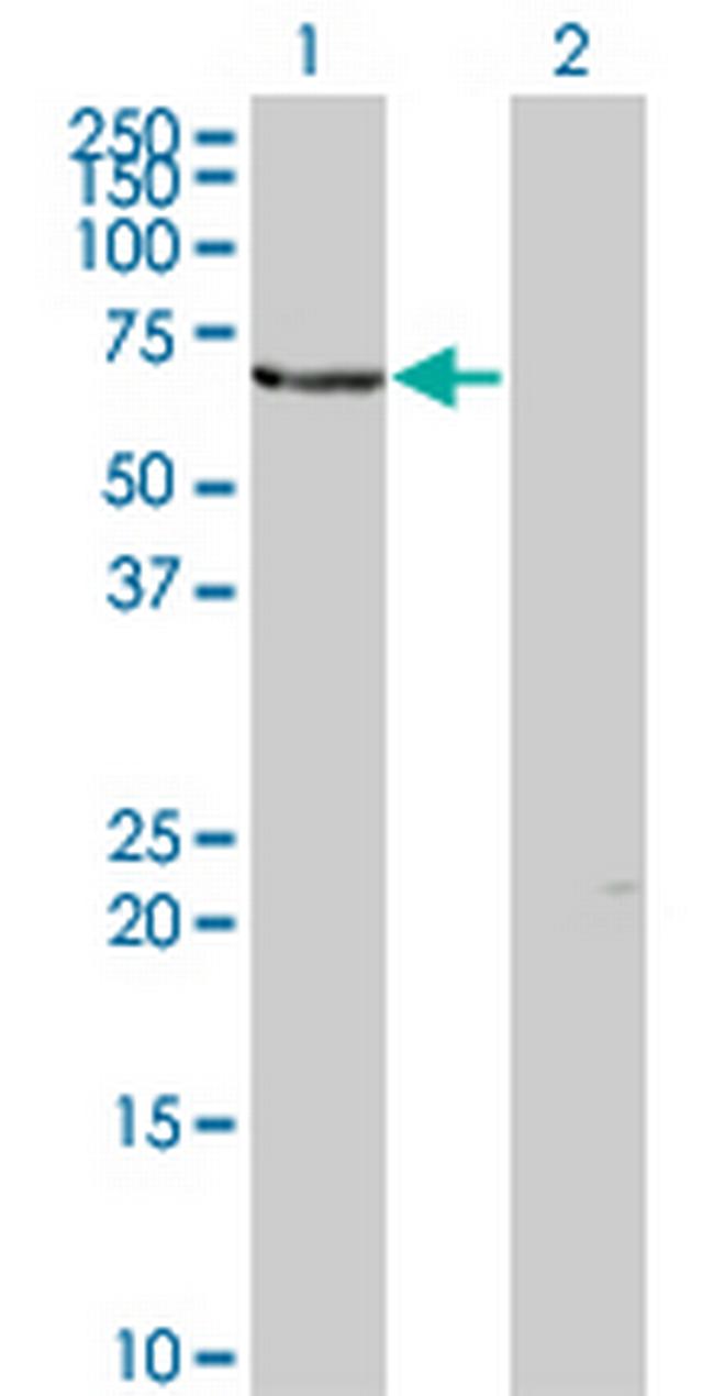 TESK2 Antibody in Western Blot (WB)