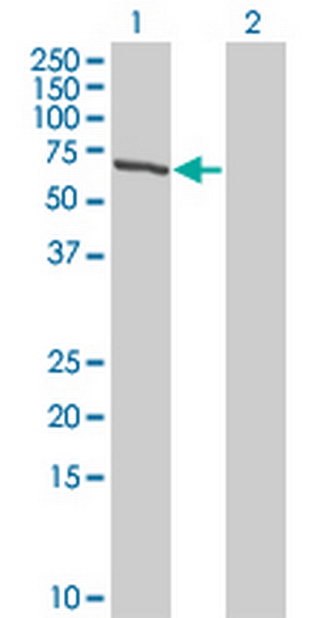 TESK2 Antibody in Western Blot (WB)