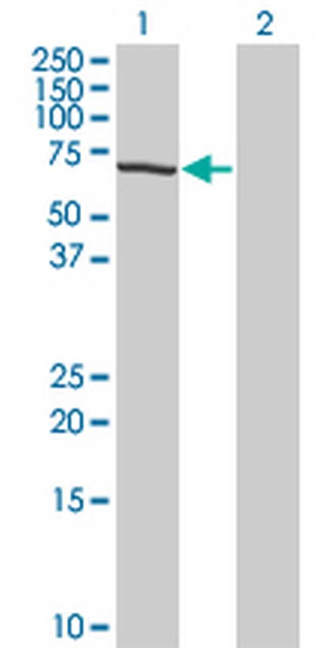 TESK2 Antibody in Western Blot (WB)