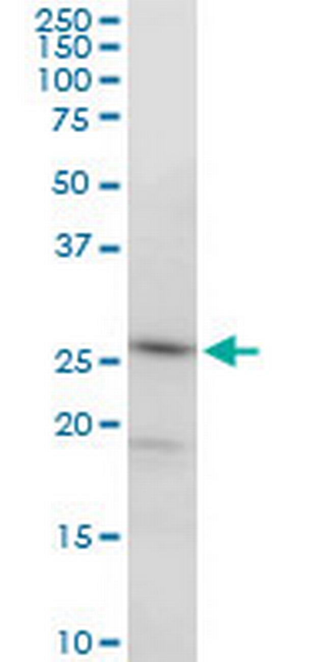 PGRMC2 Antibody in Western Blot (WB)