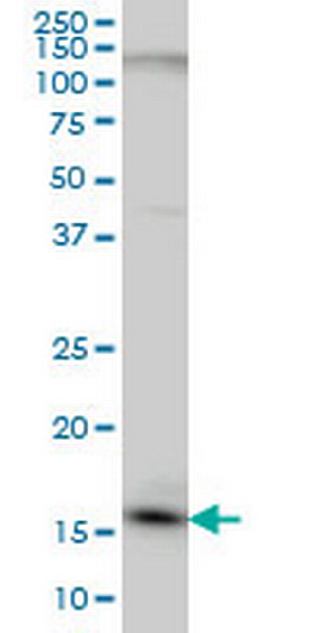 C1D Antibody in Western Blot (WB)