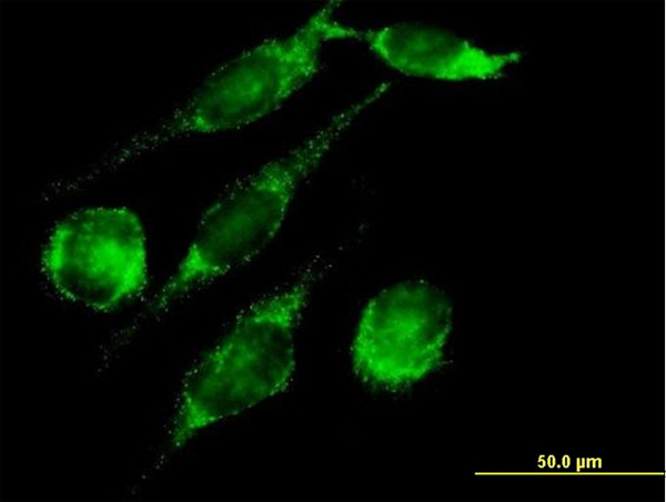 PECI Antibody in Immunocytochemistry (ICC/IF)