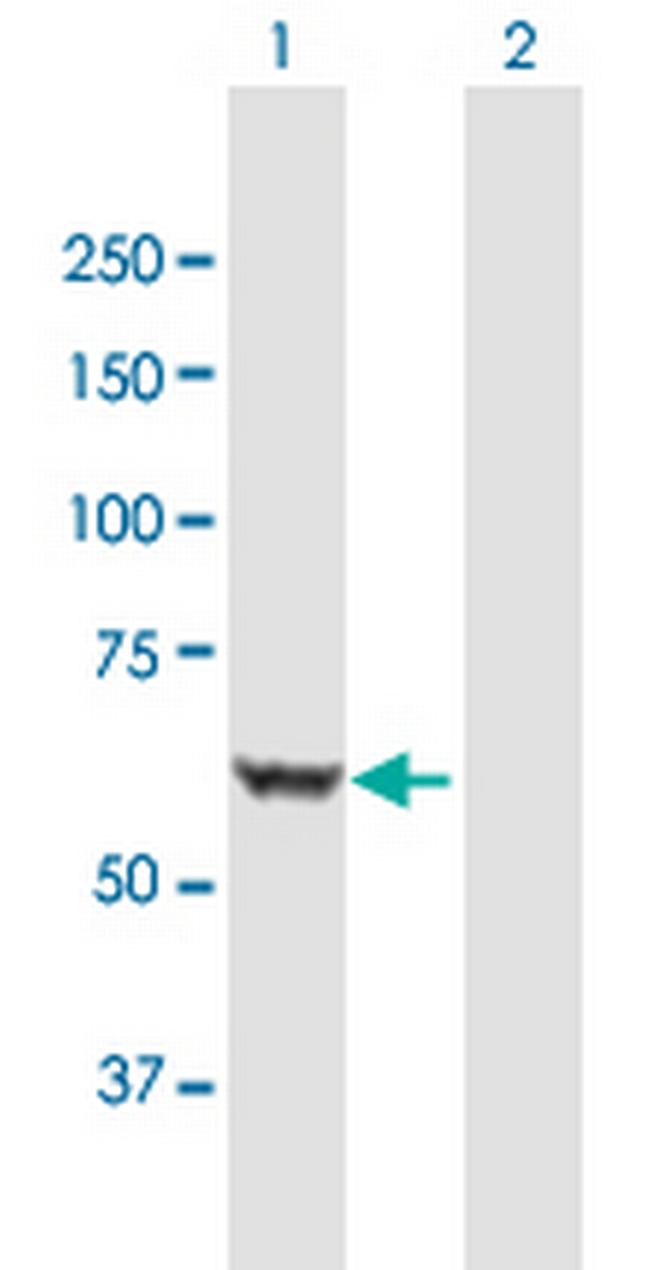 BAIAP2 Antibody in Western Blot (WB)