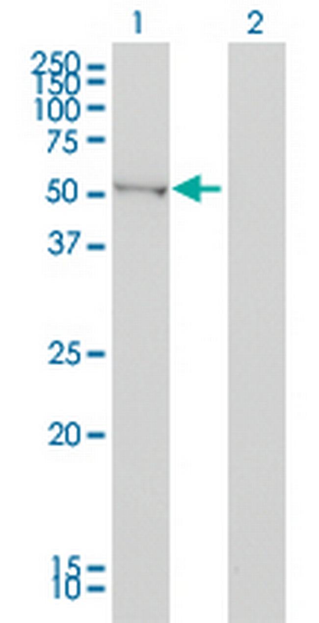 BAIAP2 Antibody in Western Blot (WB)