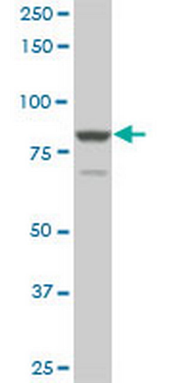 TACC3 Antibody in Western Blot (WB)