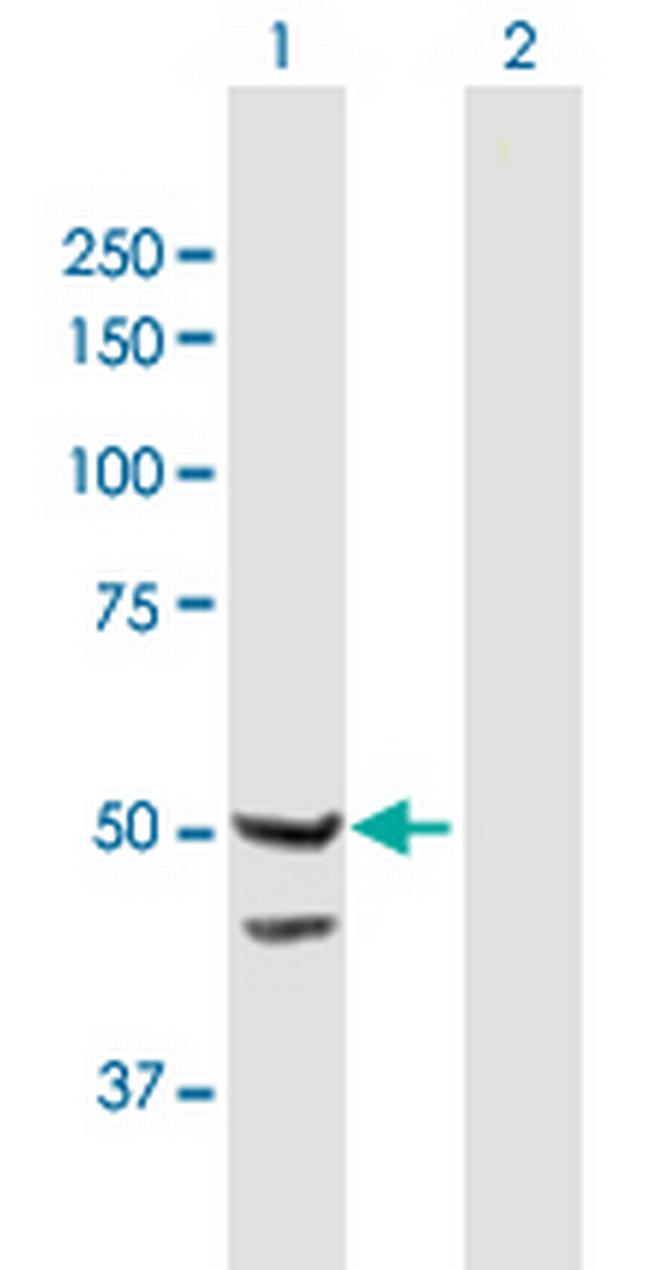 TIMM44 Antibody in Western Blot (WB)