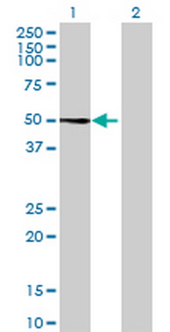 TRIM38 Antibody in Western Blot (WB)