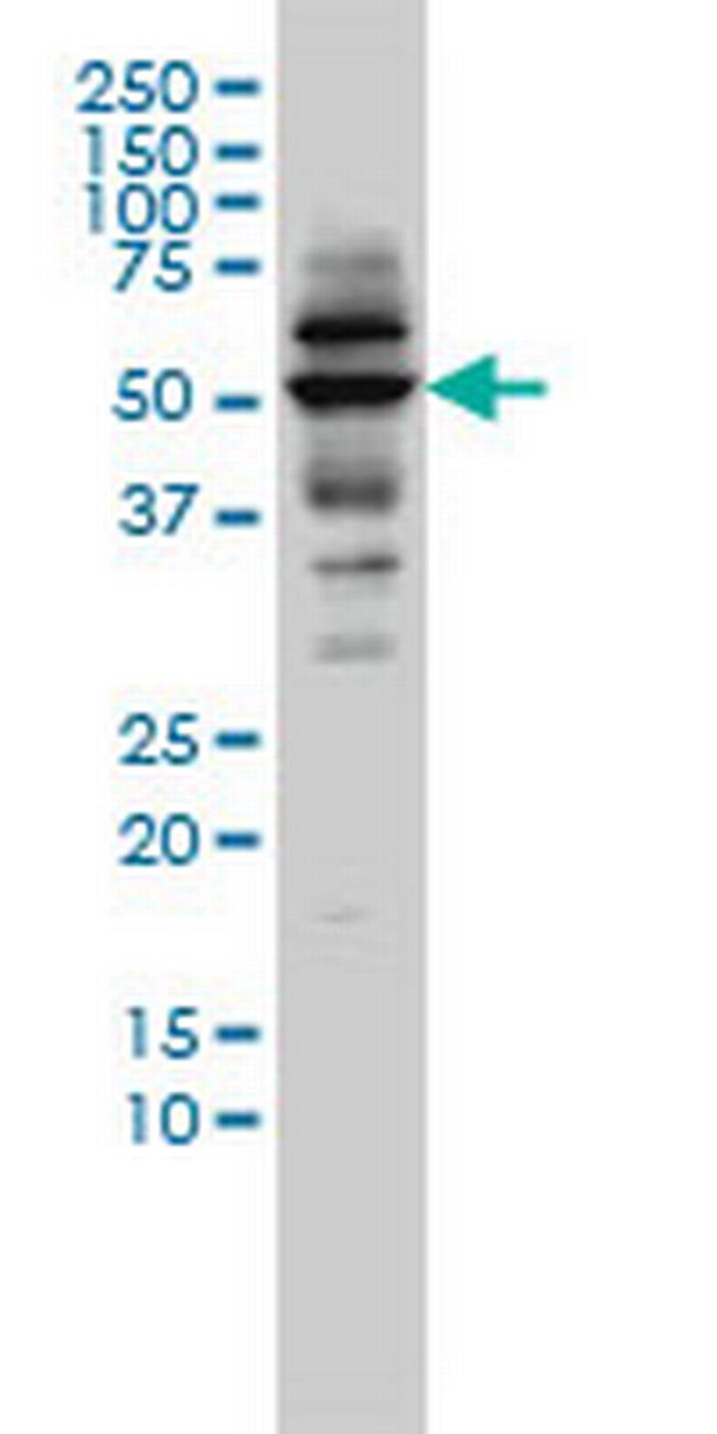 CAP2 Antibody in Western Blot (WB)
