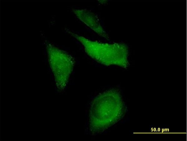 CAP1 Antibody in Immunocytochemistry (ICC/IF)