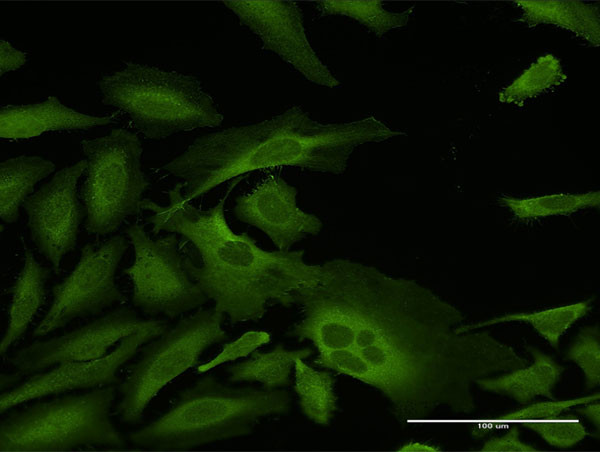 CAP1 Antibody in Immunocytochemistry (ICC/IF)