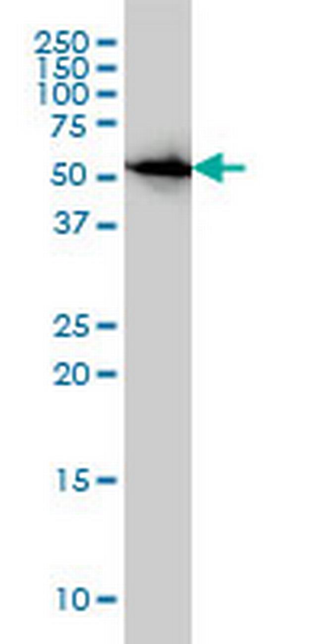 CAP1 Antibody in Western Blot (WB)