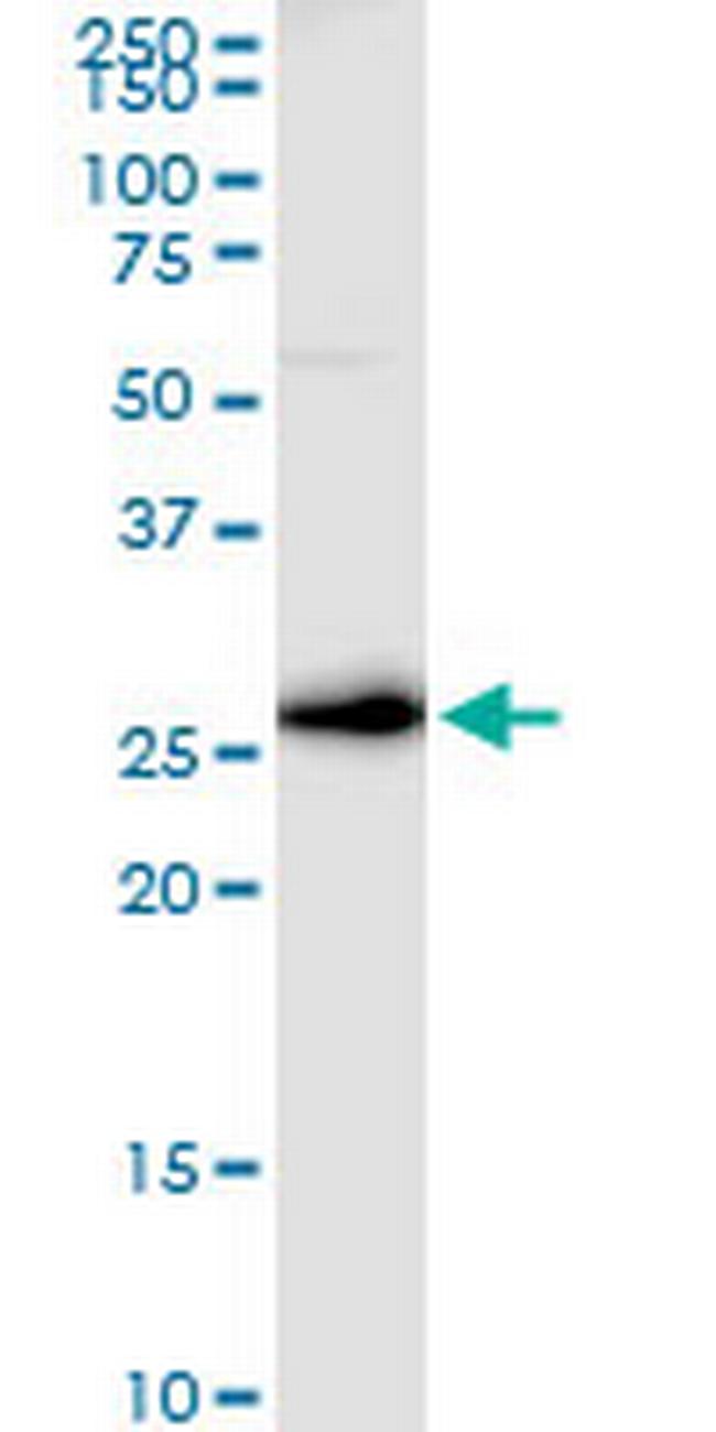 VTI1B Antibody in Western Blot (WB)