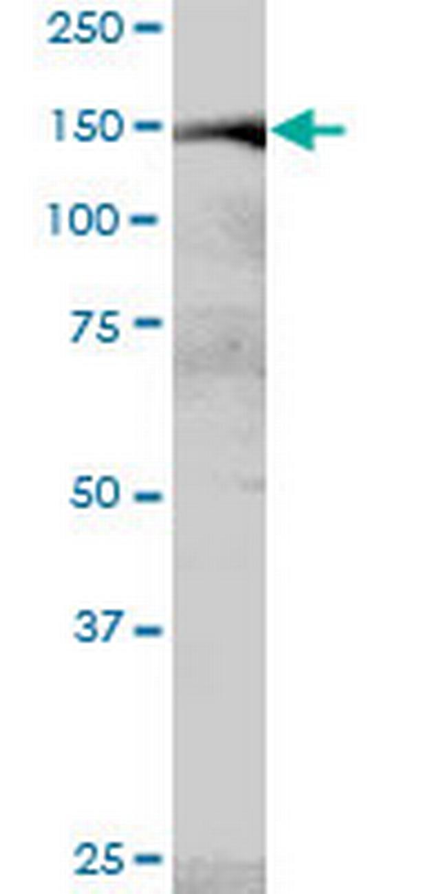 MYBBP1A Antibody in Western Blot (WB)