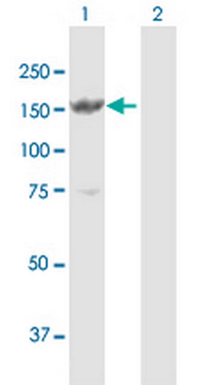 MYBBP1A Antibody in Western Blot (WB)