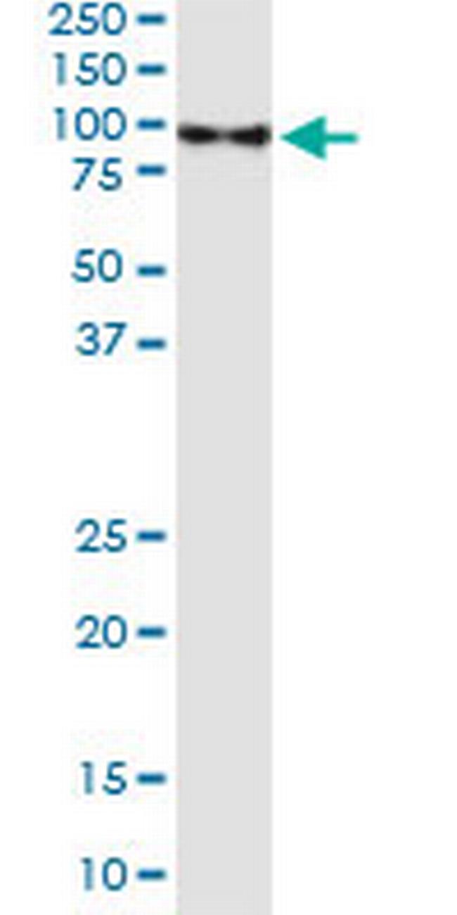 DEAF1 Antibody in Immunoprecipitation (IP)