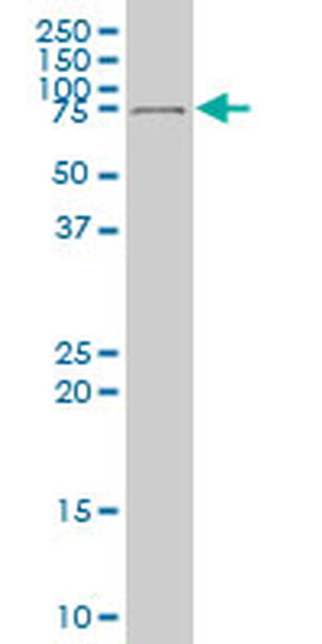 DEAF1 Antibody in Western Blot (WB)